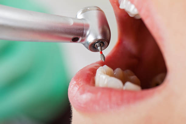 Best Pediatric Emergency Dentist in Vernonia, OR